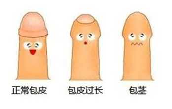 包皮1.png